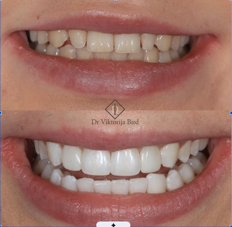 dentist in Wimbledon